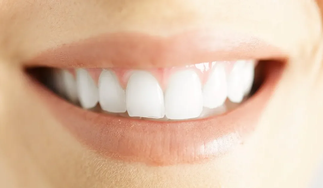 DIY teeth whitening kits sold in the malls ‘can erode enamel and make teeth more sensitive’
