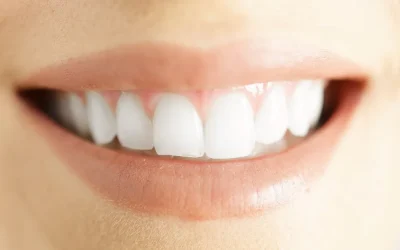 DIY teeth whitening kits sold in the malls ‘can erode enamel and make teeth more sensitive’